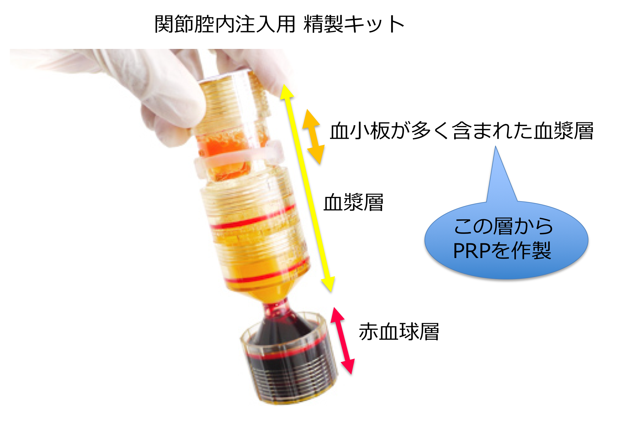 関節控内注入用精製キット